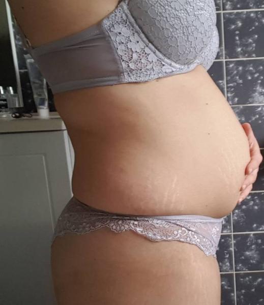 Bild zu Schwanger trotz Sterilisation? - Kinderwunsch - was tun, um schwanger zu werden?