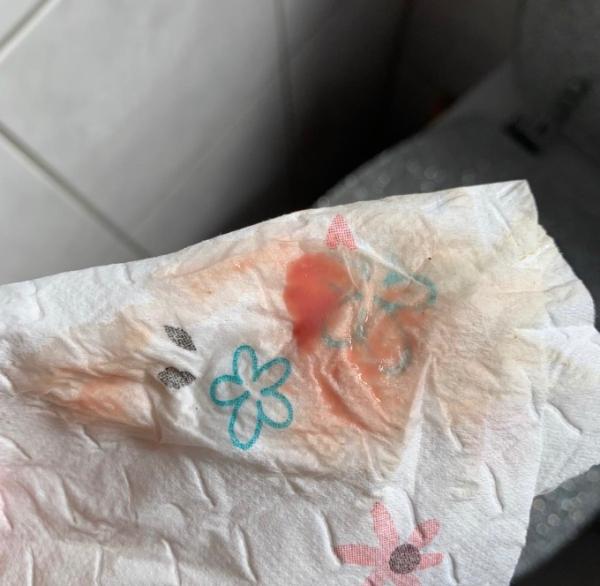 Bild zu Einnistungsblutung - Kinderwunsch - was tun, um schwanger zu werden?