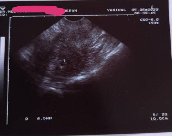 Bild zu Schwanger oder nicht? - Kinderwunsch - was tun, um schwanger zu werden?