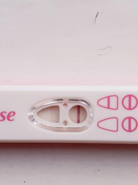 Bild zu Haarlinie??? - Kinderwunsch - was tun, um schwanger zu werden?