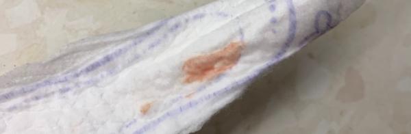 Bild zu Einnistungsblutung ? Vorsicht Bild - Kinderwunsch - was tun, um schwanger zu werden?
