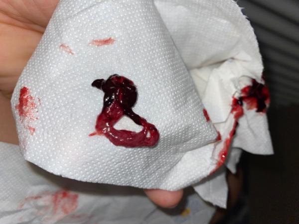 Bild zu FOTO / Biochemische Schwangerschaft - Kinderwunsch - was tun, um schwanger zu werden?