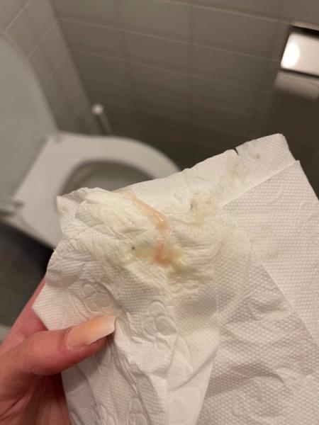 Bild zu Rosa Schleim ES+2 - ACHTUNG BILD - Kinderwunsch - was tun, um schwanger zu werden?