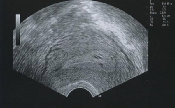Bild zu Ultraschall - Kinderwunsch - was tun, um schwanger zu werden?