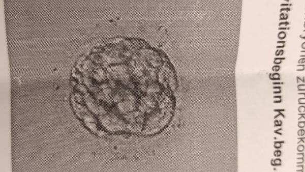 Bild zu Eizelle Qualität - wie schätzt ihr es ein? - Kinderwunsch - was tun, um schwanger zu werden?