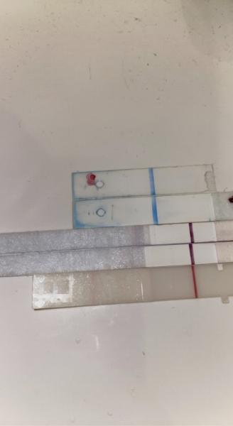 Bild zu Verdunstungsline bei 5 Tests? - Kinderwunsch - was tun, um schwanger zu werden?