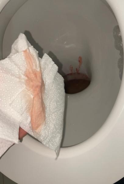 Bild zu Schmierblutung Staat Periode Achtung Bild ! - Kinderwunsch - was tun, um schwanger zu werden?
