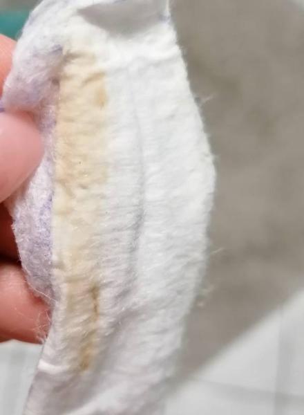 Bild zu Seltsamer Ausfluss - Kinderwunsch - was tun, um schwanger zu werden?