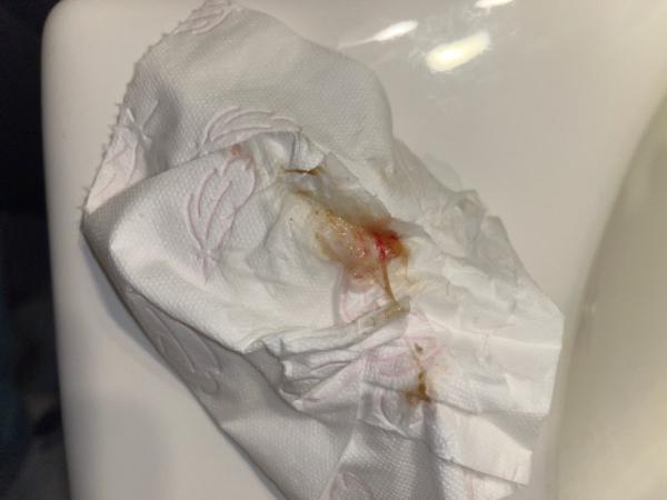 Bild zu Was ist das - Kinderwunsch - was tun, um schwanger zu werden?