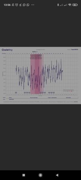 Bild zu Zykluskurve - Kinderwunsch - was tun, um schwanger zu werden?