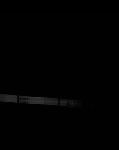 Bild zu ST negativ? Oder doch ein Schatten? - Kinderwunsch - was tun, um schwanger zu werden?