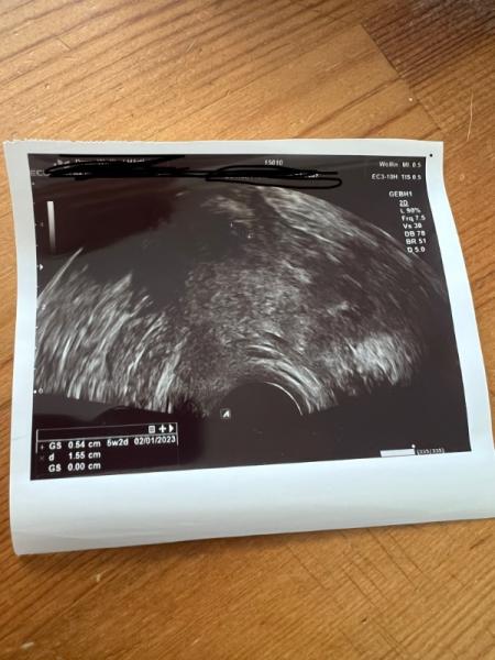 Bild zu Ist das eine Fruchthöhle oder nicht - Kinderwunsch - was tun, um schwanger zu werden?