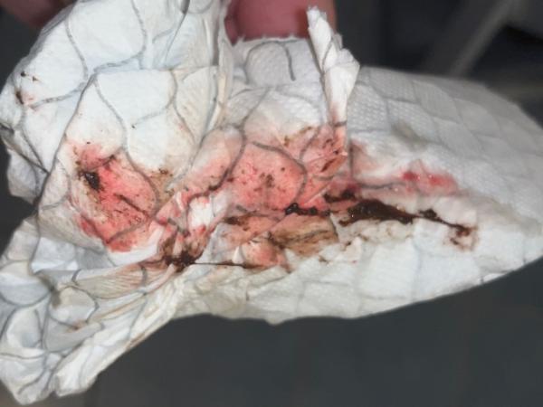 Bild zu Schmierblutung oder Mens? Eure Meinung - Kinderwunsch - was tun, um schwanger zu werden?