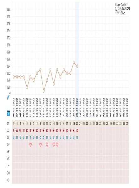 Bild zu Basaltemperatur - Kinderwunsch - was tun, um schwanger zu werden?