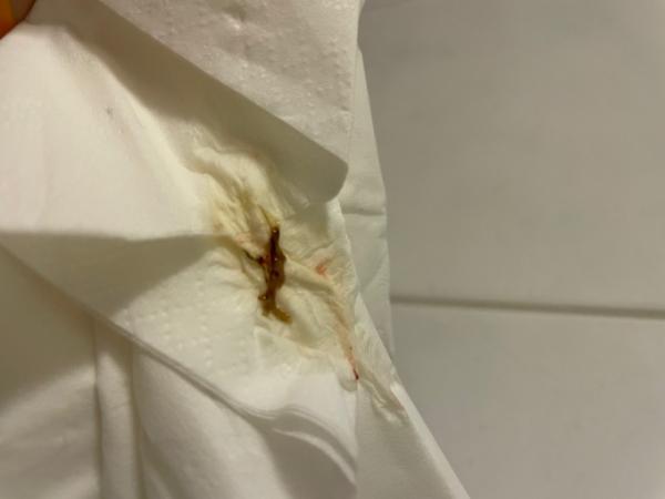 Bild zu Abgang???? - Kinderwunsch - was tun, um schwanger zu werden?