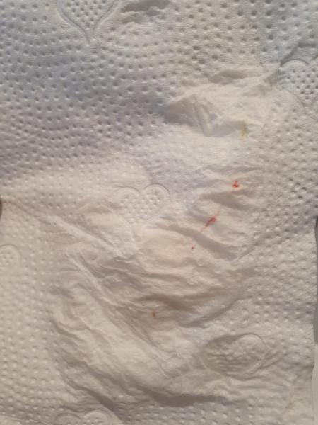 Bild zu Einnistungsblutung?? TW Bild - Kinderwunsch - was tun, um schwanger zu werden?