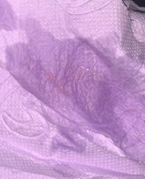 Bild zu Eisprung +6/7 einnistungsblutung? ( ACHTUNG BILD‼️) - Kinderwunsch - was tun, um schwanger zu werden?