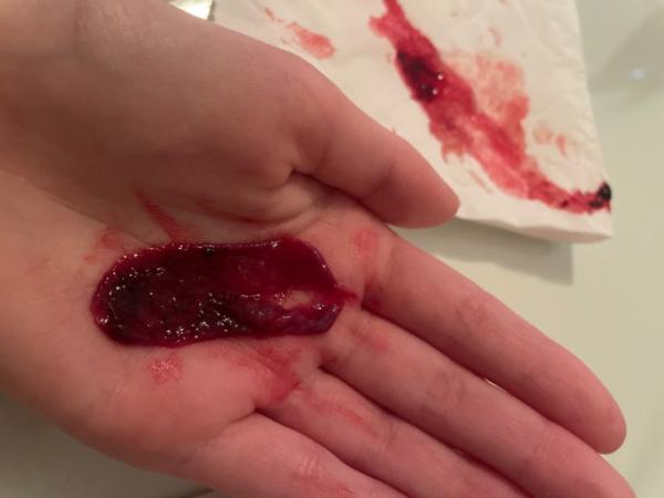 Bild zu Kind abgegangen? Trigger Warnung - Kinderwunsch - was tun, um schwanger zu werden?