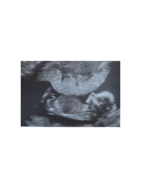 Bild zu Nub Theorie ? - Kinderwunsch - was tun, um schwanger zu werden?