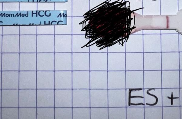 Bild zu Positiv oder negativ? Blut-Schwangerschaftstest - Kinderwunsch - was tun, um schwanger zu werden?