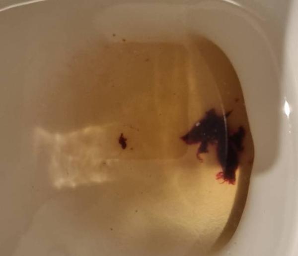 Bild zu Brauche eure Hilfe 😭 ! Achtung Bild mit Blut! - Kinderwunsch - was tun, um schwanger zu werden?