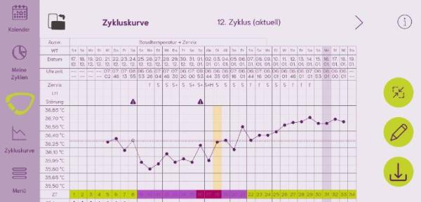 Bild zu Auswertung der Temperaturkurve - Kinderwunsch - was tun, um schwanger zu werden?