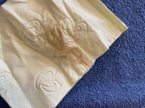 Bild zu Schwanger? - Kinderwunsch - was tun, um schwanger zu werden?
