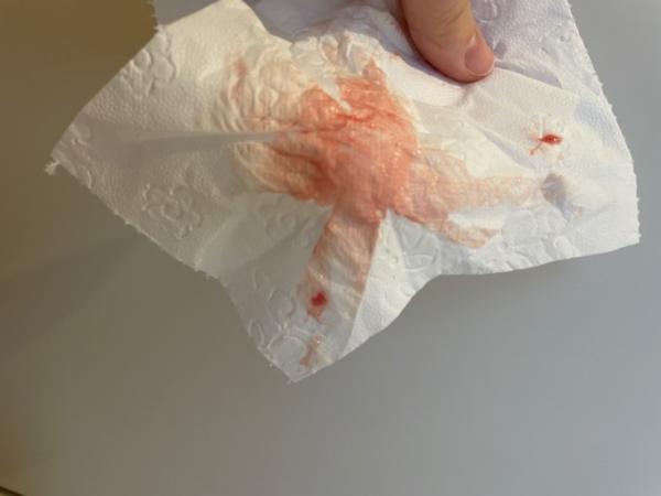 Bild zu Einnistungsblutung es+10 - Kinderwunsch - was tun, um schwanger zu werden?