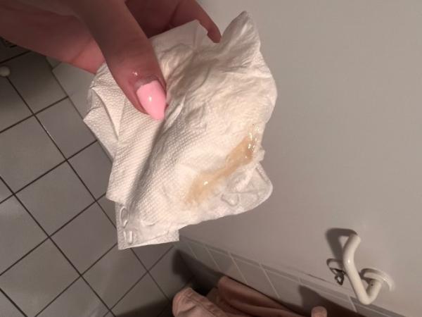 Bild zu Achtung Bild!! Schmierblutung? - Kinderwunsch - was tun, um schwanger zu werden?
