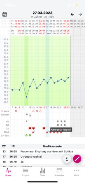 Bild zu Wieso steigt meine Temperatur nicht - Kinderwunsch - was tun, um schwanger zu werden?
