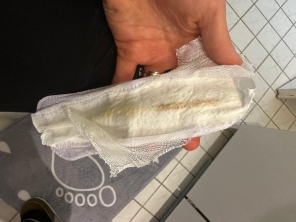 Bild zu Einnistungsblutung ? - Kinderwunsch - was tun, um schwanger zu werden?