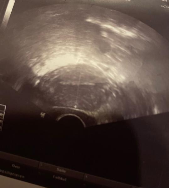 Bild zu Ultraschall? Erfahrungen? - Kinderwunsch - was tun, um schwanger zu werden?