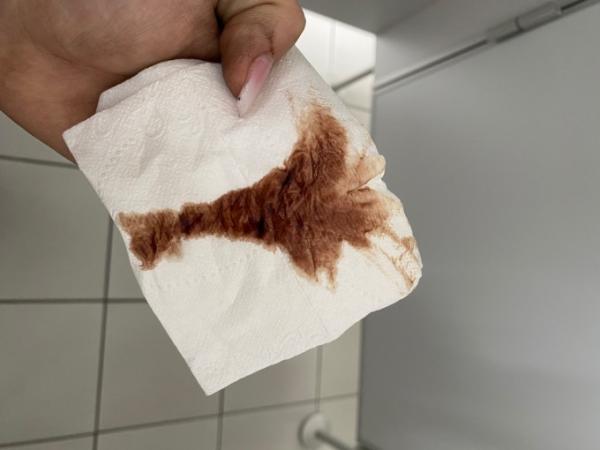 Bild zu Schmierblutung? - Kinderwunsch - was tun, um schwanger zu werden?