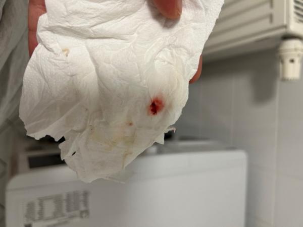 Bild zu Eisprungsblutung? Foto - Kinderwunsch - was tun, um schwanger zu werden?