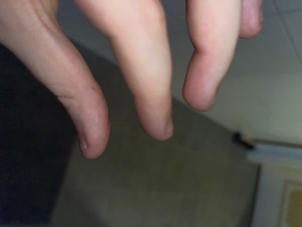 Bild zu Schwanger? - Kinderwunsch - was tun, um schwanger zu werden?