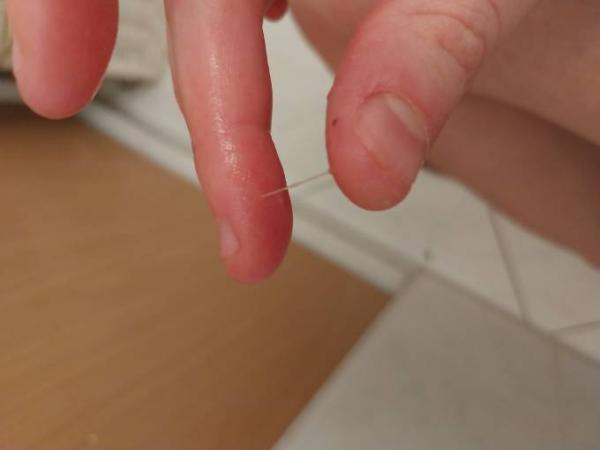Bild zu Durchsichtiger milchiger spinnbarer usfluss ES+10 - Kinderwunsch - was tun, um schwanger zu werden?