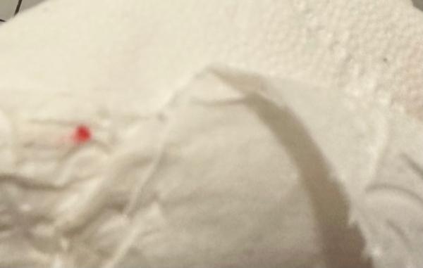 Bild zu Mini Blut punkt auf dem Toilettenpapier? - Kinderwunsch - was tun, um schwanger zu werden?