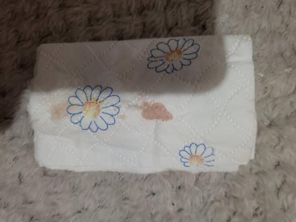 Bild zu Gestern schwach positiv, heute Blutung, morgen NMT... Bitte um Meinung - Kinderwunsch - was tun, um schwanger zu werden?