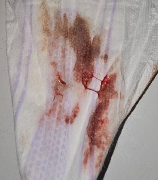 Bild zu Einnistungsblutung oder Periode - Kinderwunsch - was tun, um schwanger zu werden?