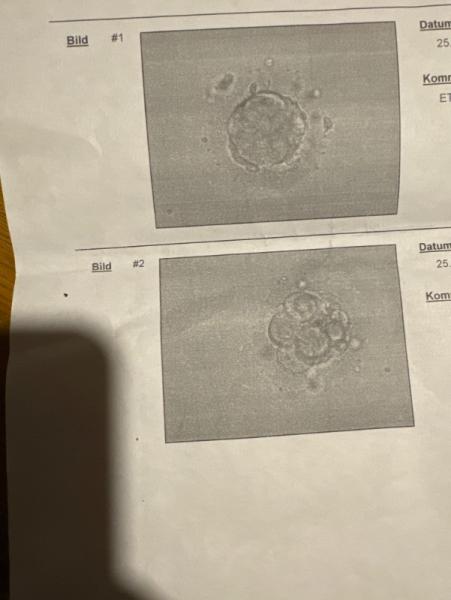 Bild zu PU+6 TF+3 - Kinderwunsch - was tun, um schwanger zu werden?