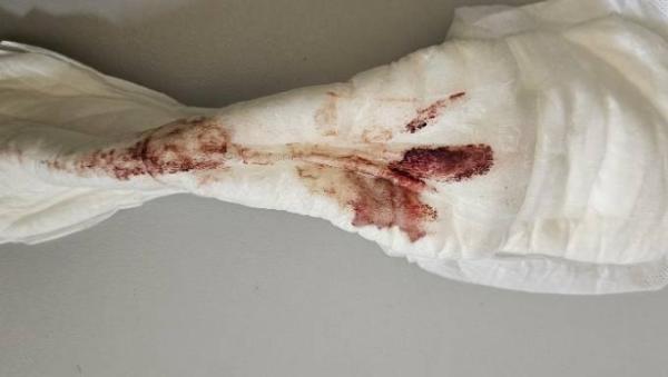Bild zu Einnistungsblutung oder Periode VORISCHT FOTO - Kinderwunsch - was tun, um schwanger zu werden?