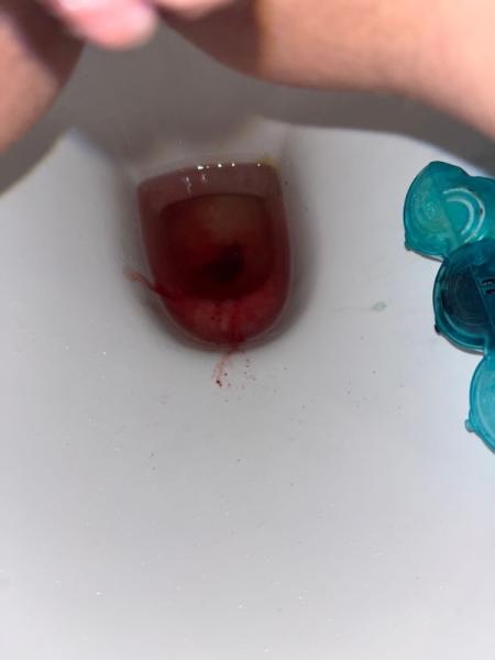 Bild zu Abgang 😓 - Kinderwunsch - was tun, um schwanger zu werden?