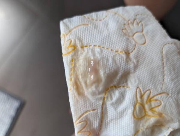 Bild zu Ist das von der Einnistung? Vorsichtig ist mit Bild! - Kinderwunsch - was tun, um schwanger zu werden?