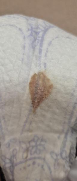 Bild zu Ausfluss   -Achtung Foto - Kinderwunsch - was tun, um schwanger zu werden?