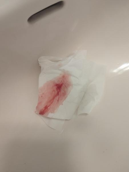 Bild zu Blutung 16. Zyklustag - Kinderwunsch - was tun, um schwanger zu werden?