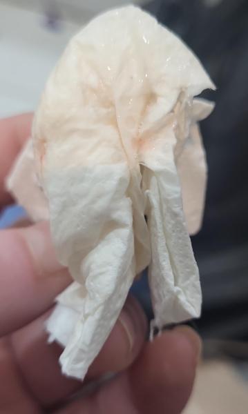 Bild zu Ich brauche mal euren rat - Kinderwunsch - was tun, um schwanger zu werden?