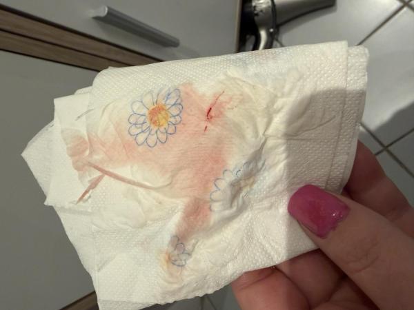 Bild zu Einnistungsblutung// Vorsicht Bild - Kinderwunsch - was tun, um schwanger zu werden?