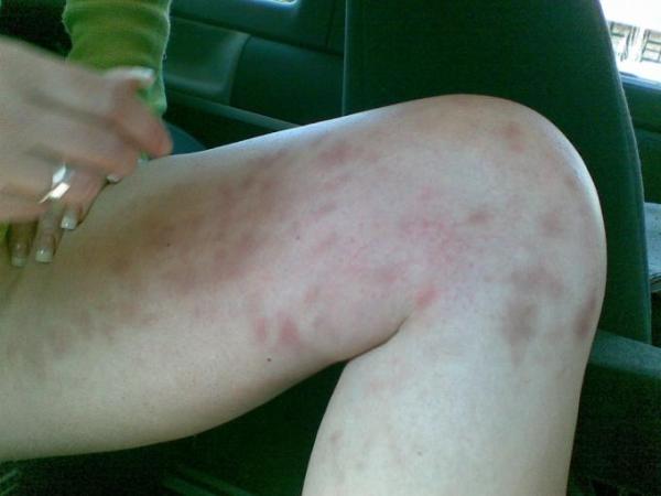 Bild zu eine medizinische Frage ! - Aktuelles