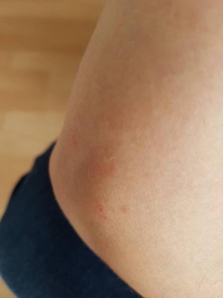 Bild zu Leewja, hätte eine hautfrage - Aktuelles