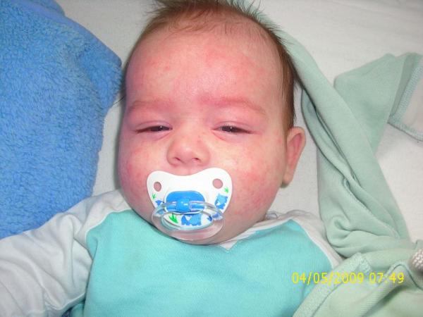 Bild zu @nella, little sunshine 3 und alle die mir geantwortet hatten... - Forum für Januar - Mamis